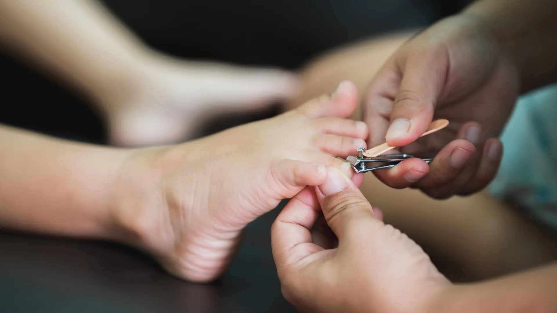 Cortar bien las uñas de los pies 